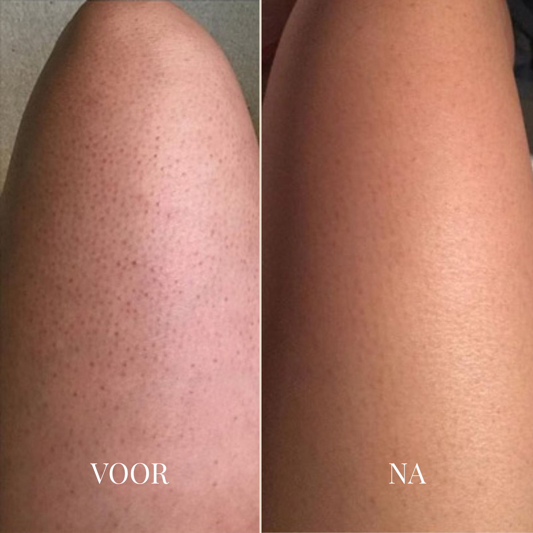 BareGlow Comfort Peeling-Gel