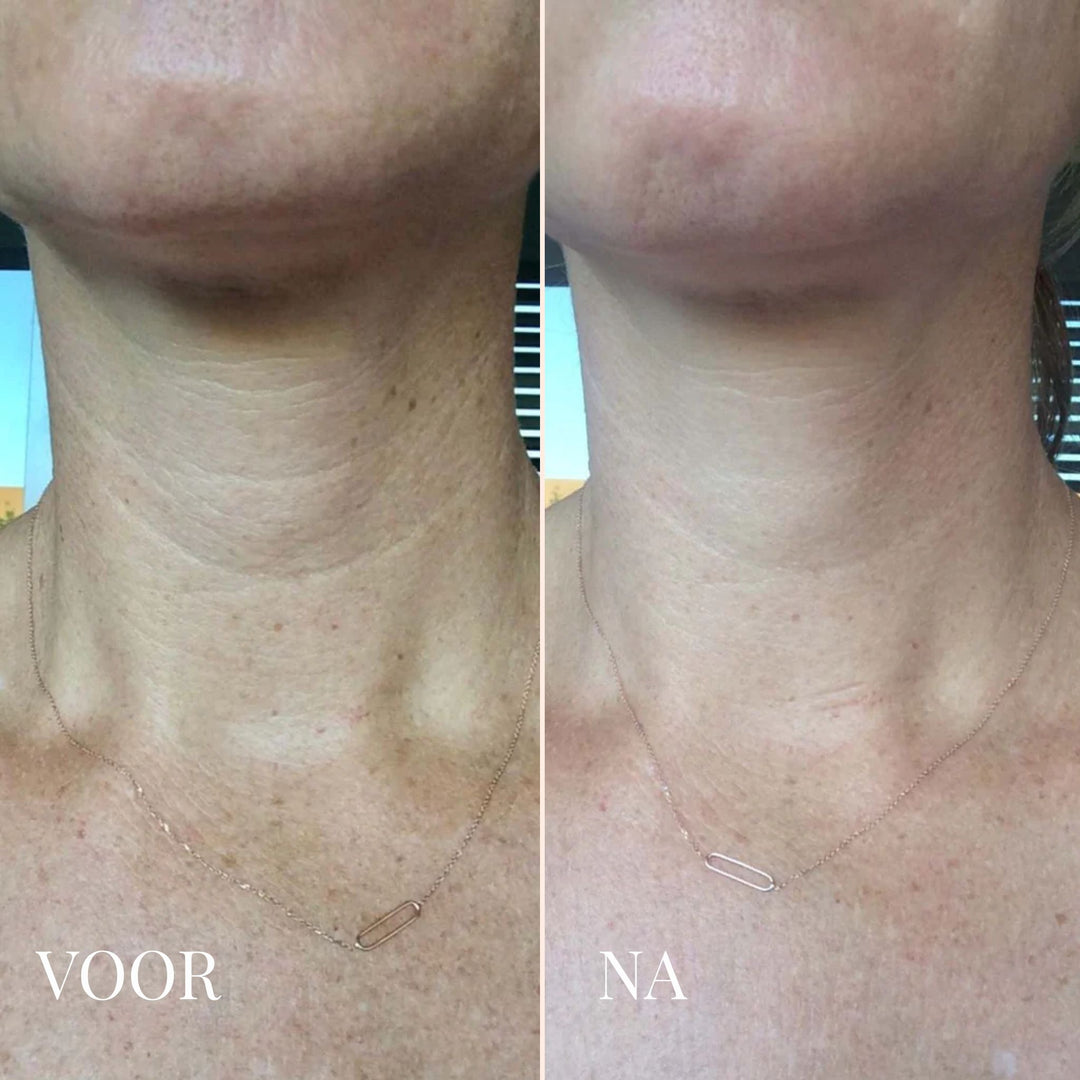 Viareline Collageen Masker