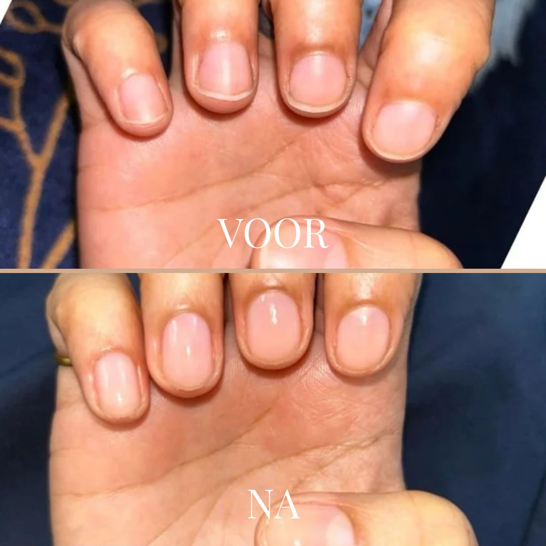 GentleGrip Elektrische Nagelknipper