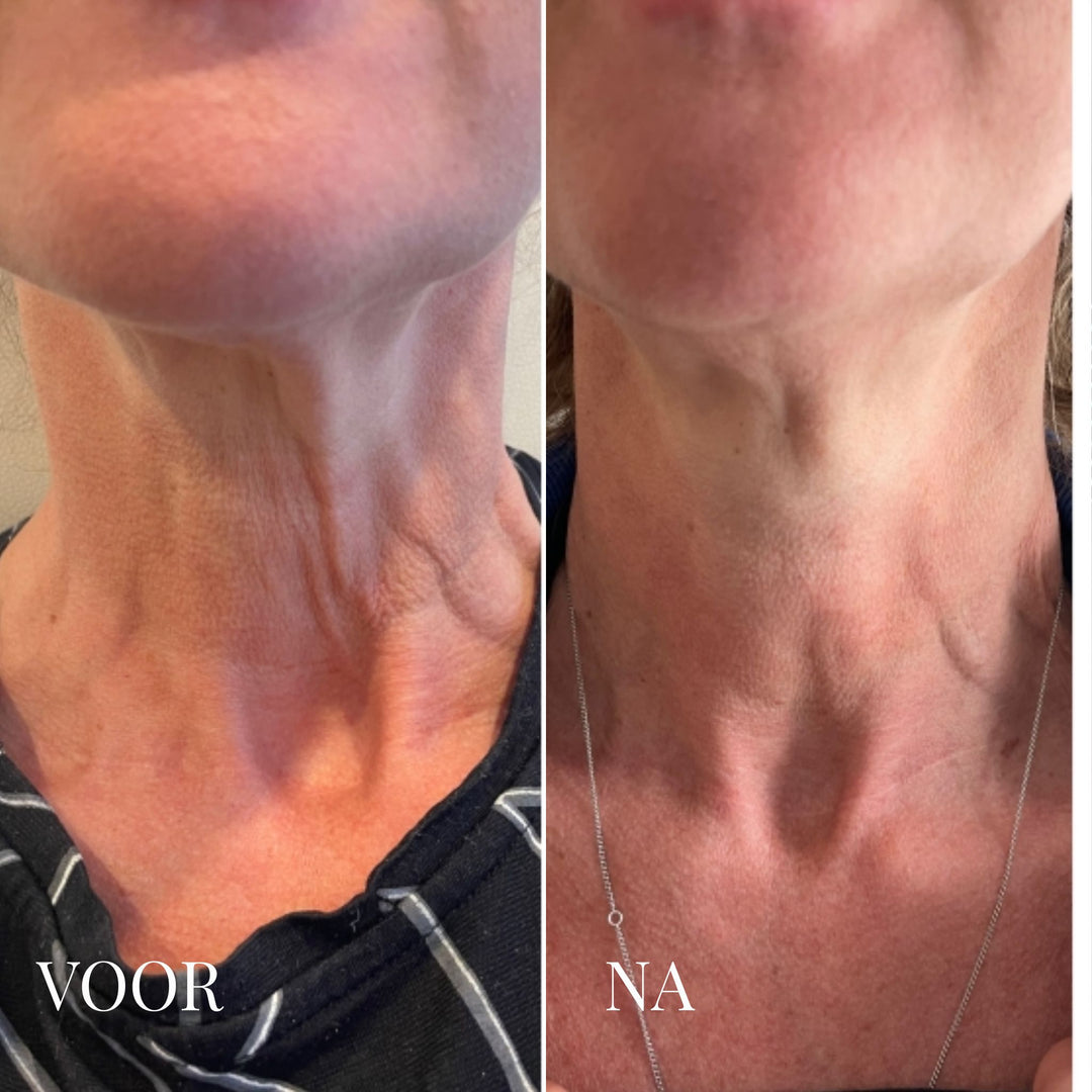 Viareline Collageen Masker