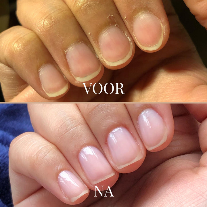 GentleGrip Elektrische Nagelknipper