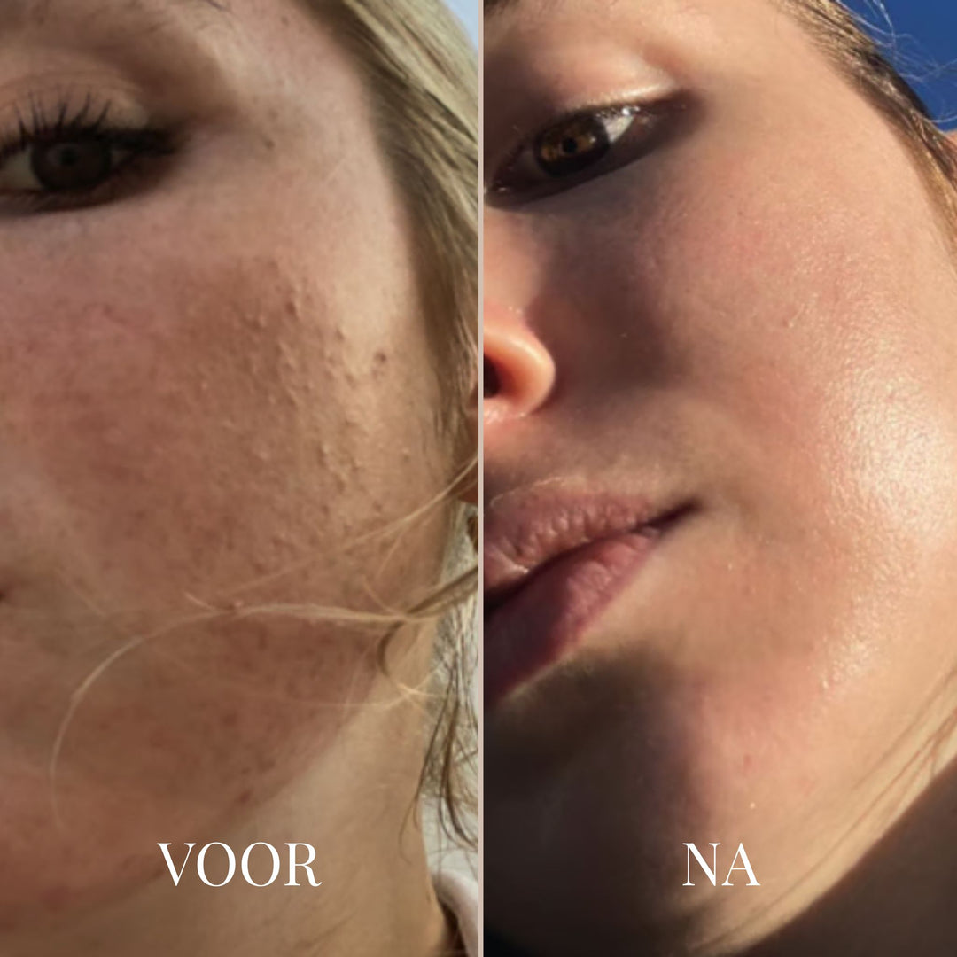 STEVIGGLOW RETINOL SHOT TIGHTENING CRÈME