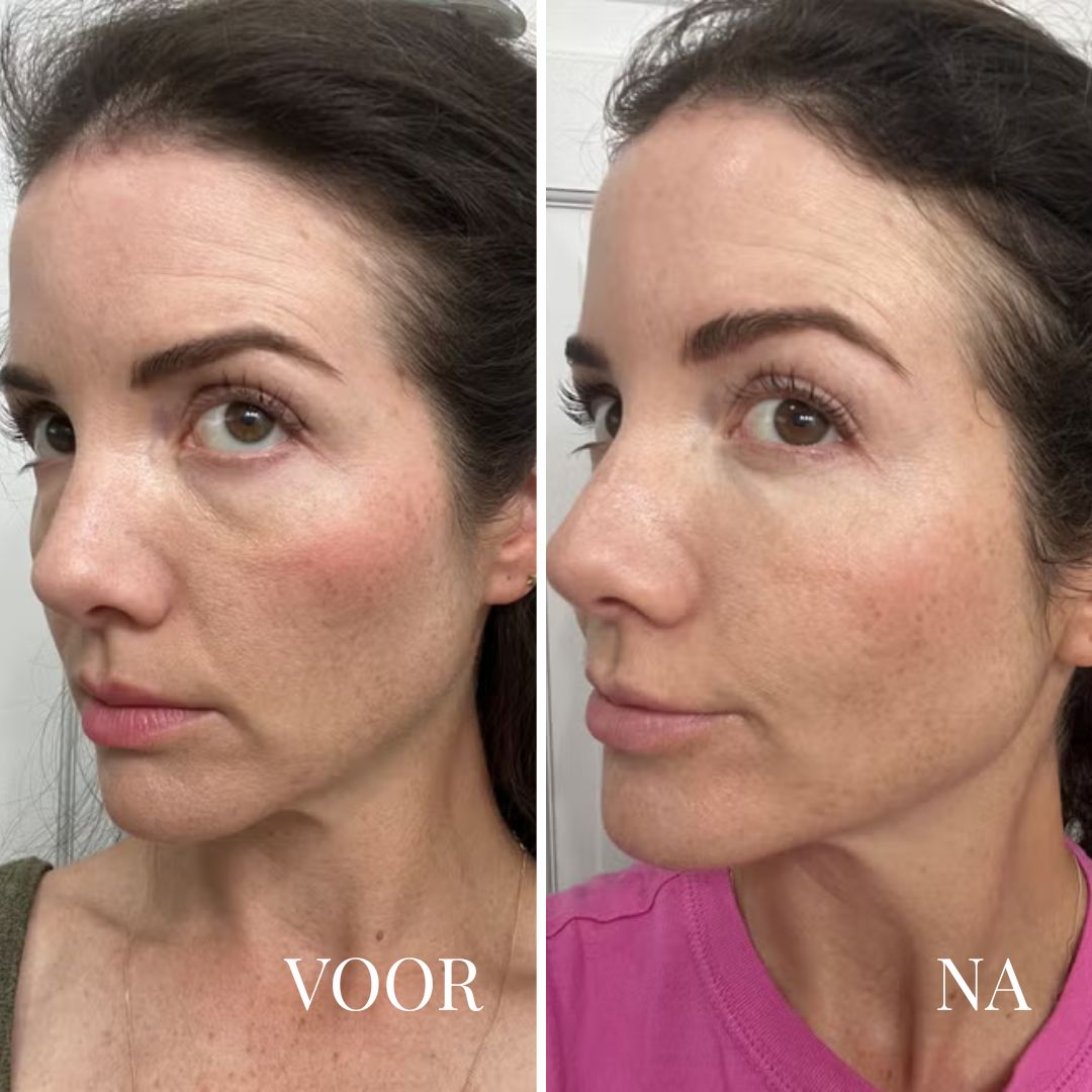 Dr. Melaxin | Morning Glow Corrector