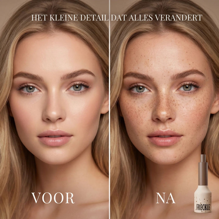 FRECKLESTAMPS ZOMERSPROETJES