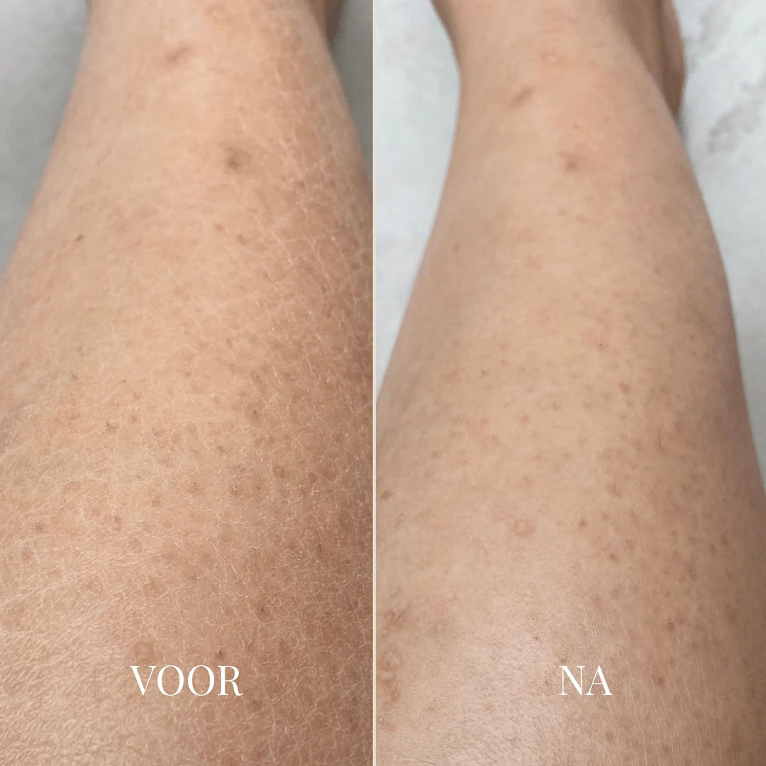 BareGlow Comfort Peeling-Gel