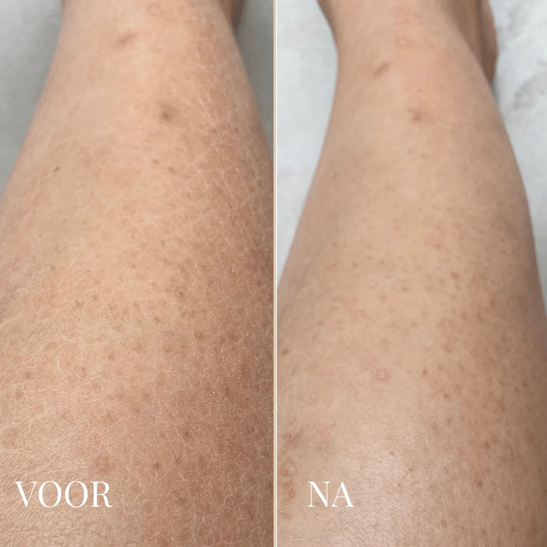 Dr. Melaxin Lichaamspeeling Spray