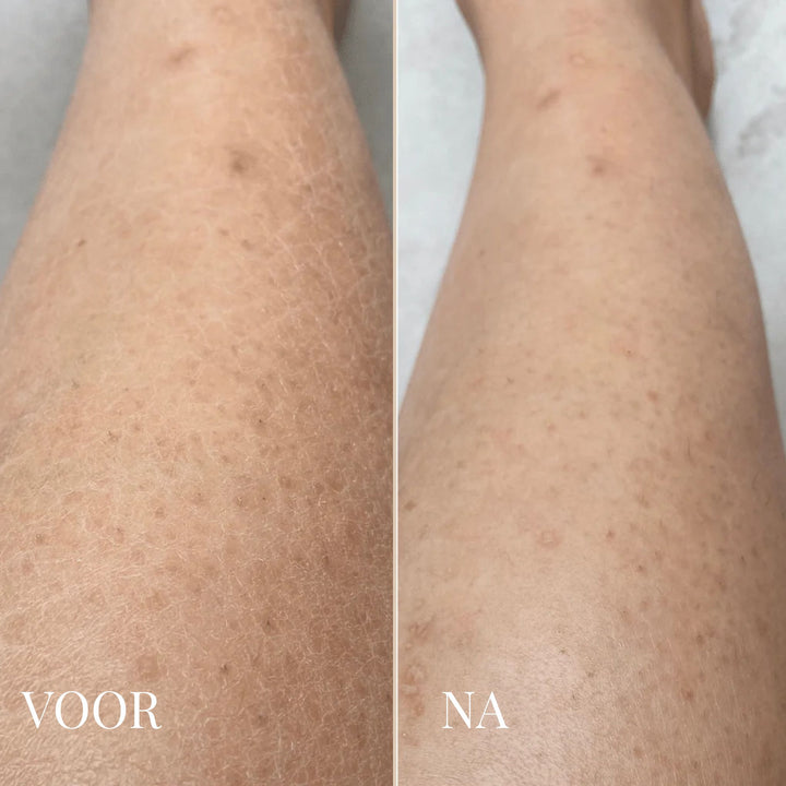 Dr. Melaxin Lichaamspeeling Spray