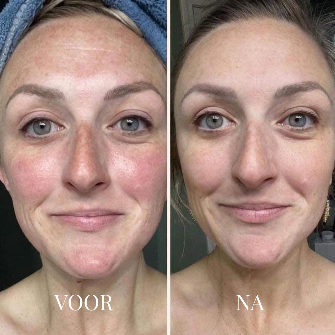 FRESHLIFT | KOREAANS COLLAGEENMASKER VOOR DE RIJPE HUID