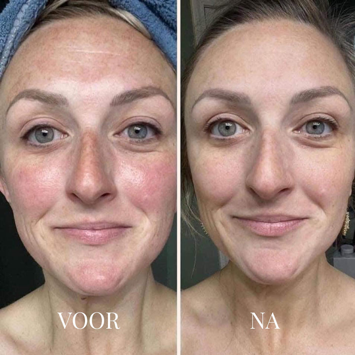 FRESHLIFT | KOREAANS COLLAGEENMASKER VOOR DE RIJPE HUID