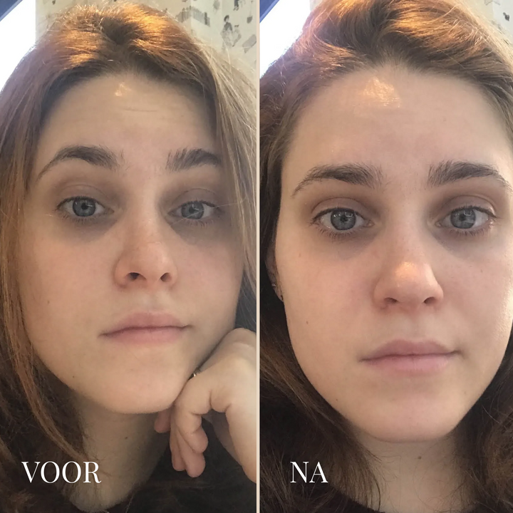 BrightFix Concealer