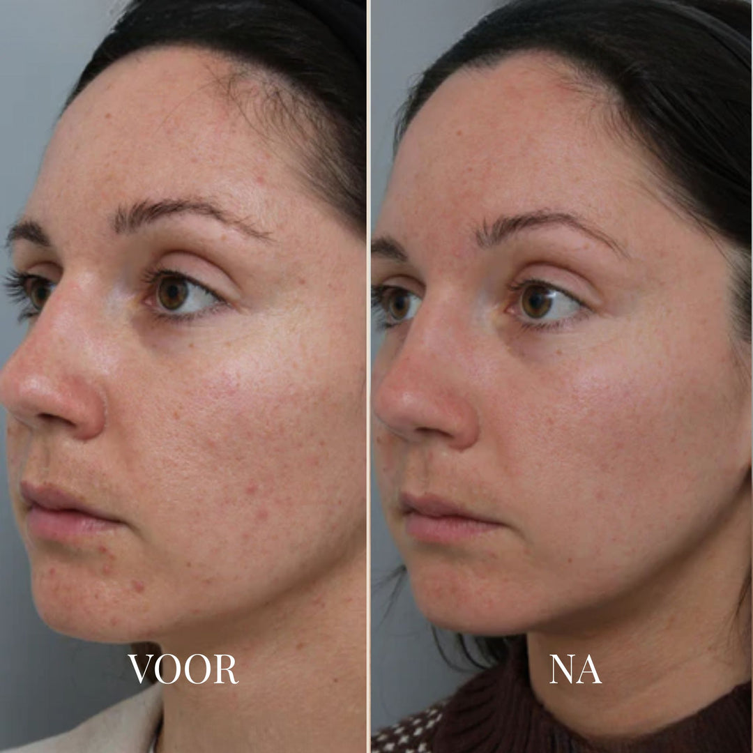 BareGlow Comfort Peeling-Gel