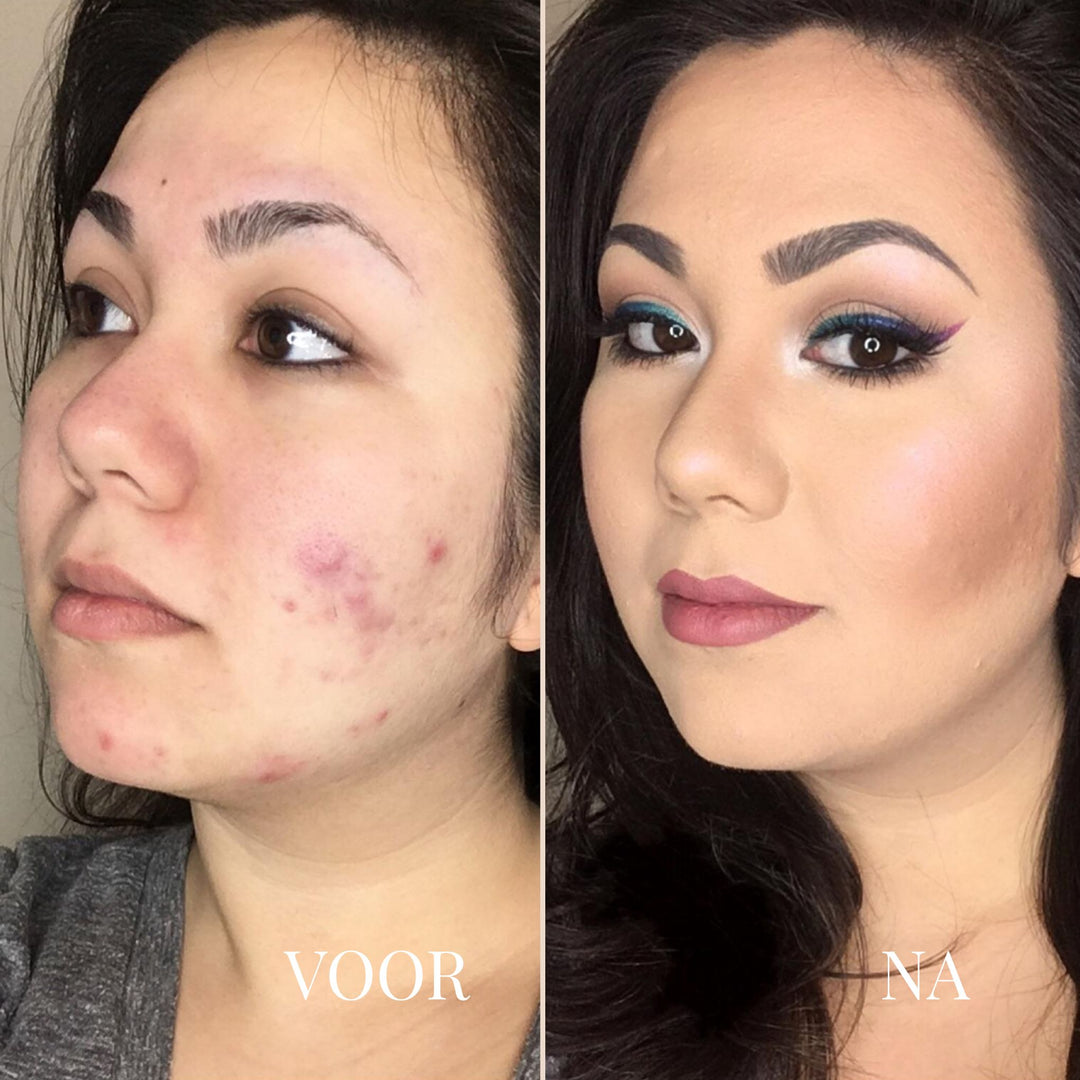 3-in-1 Perfectie Concealer