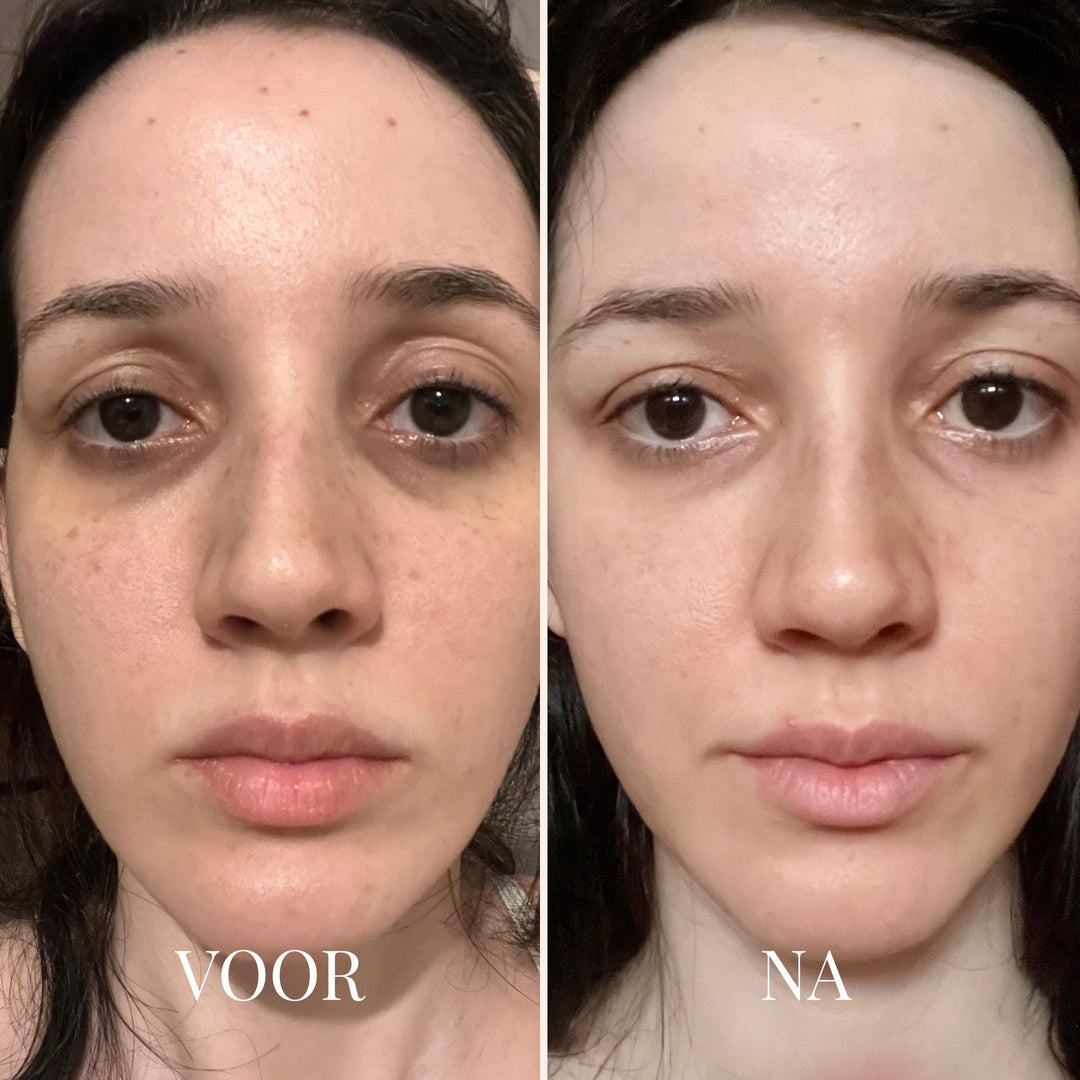 FRESHLIFT | KOREAANS COLLAGEENMASKER VOOR DE RIJPE HUID