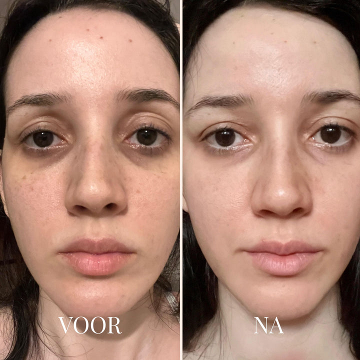 FRESHLIFT | KOREAANS COLLAGEENMASKER VOOR DE RIJPE HUID