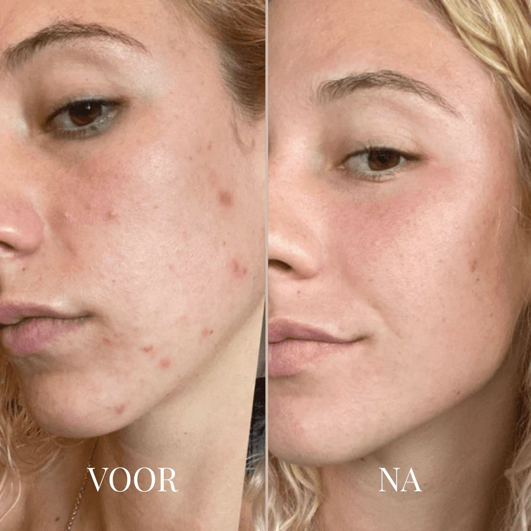 STEVIGGLOW RETINOL SHOT TIGHTENING CRÈME