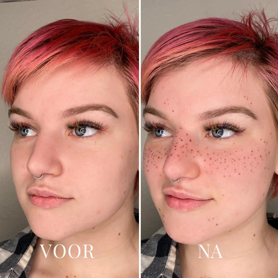 FRECKLESTAMPS ZOMERSPROETJES