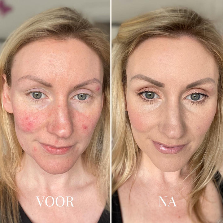 HEROKA OOGCONCEALER STICK