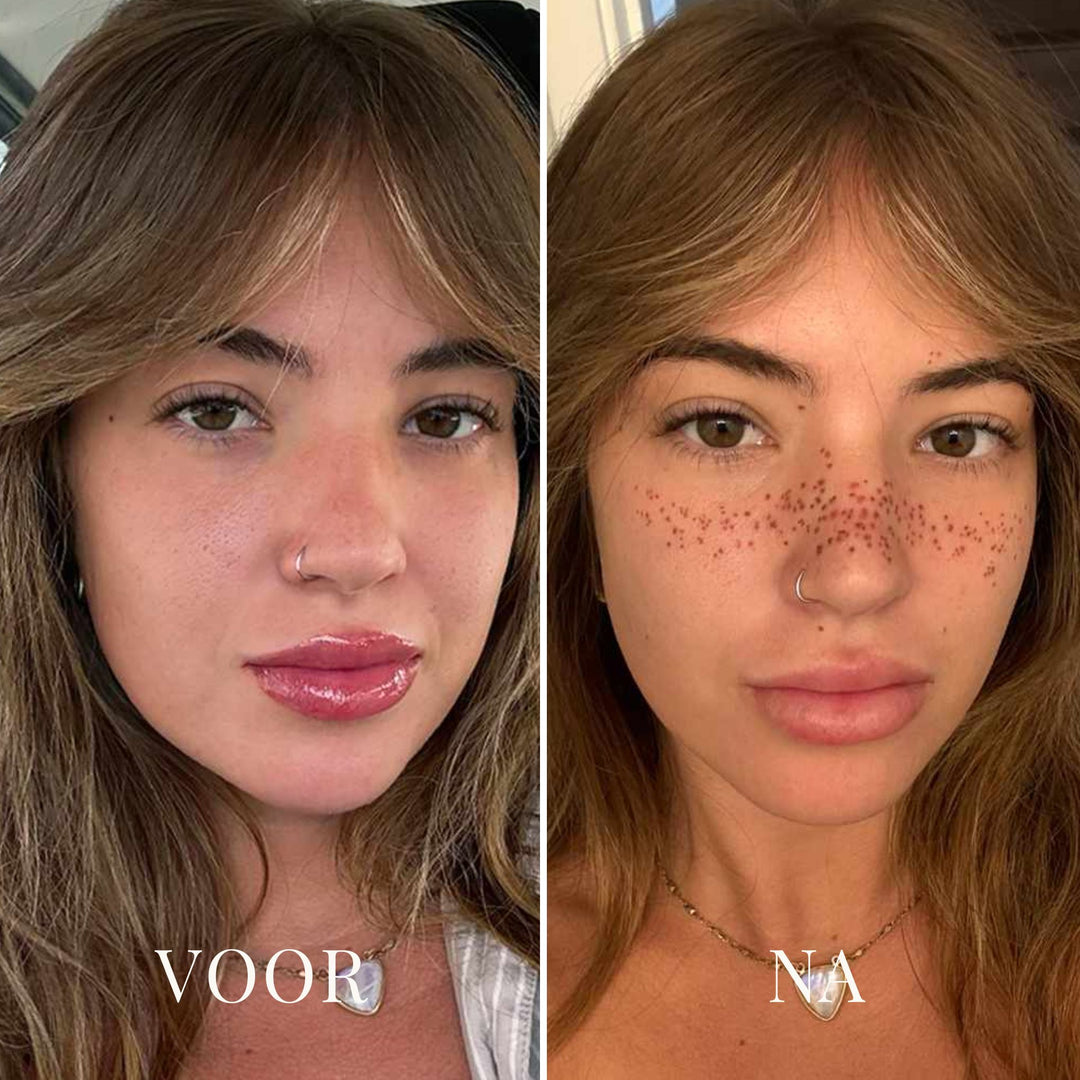 FRECKLESTAMPS ZOMERSPROETJES