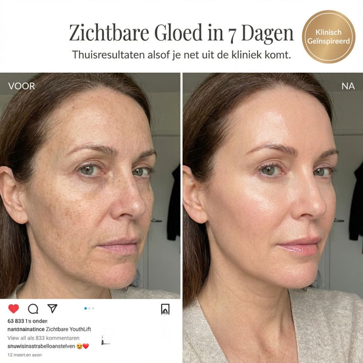 YOUTHLIFT ANTI-VEROUDERINGS KIT