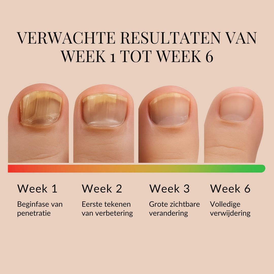 ReviveNail Herstelpleisters