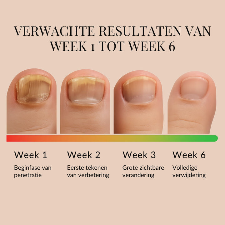 ReviveNail Herstelpleisters