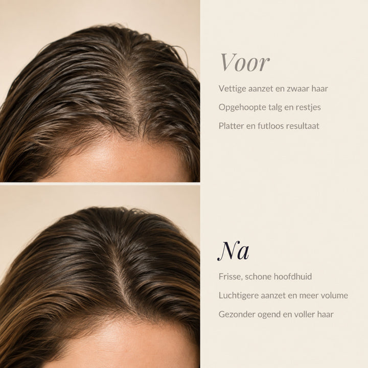 ROOTVIVE HAIR SHAMPOOBAR | VERSTERKT JE HAARWORTELS