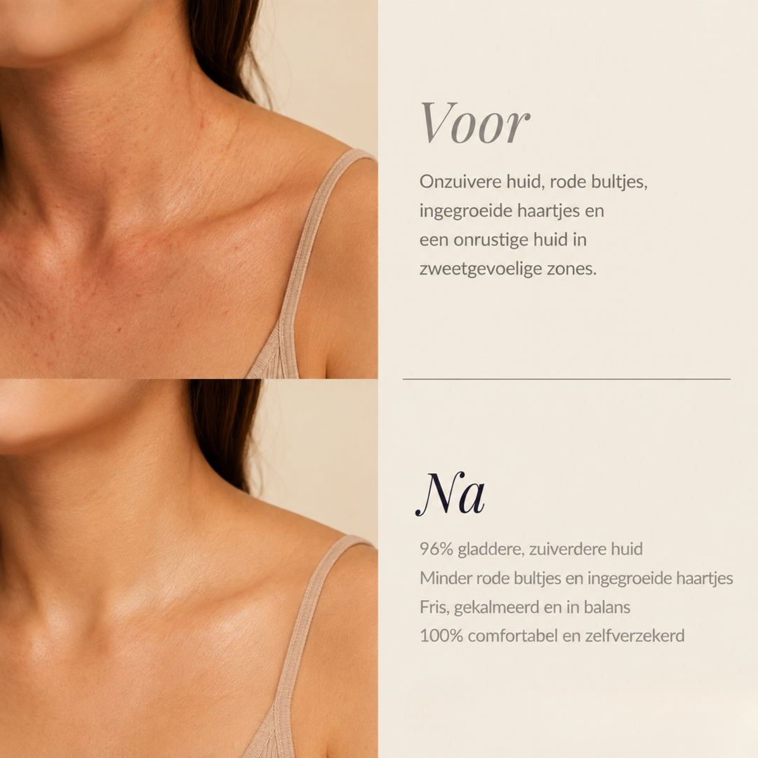 TeaFresh Body Bar | FRIS WAAR JE HET MEEST ZWEET