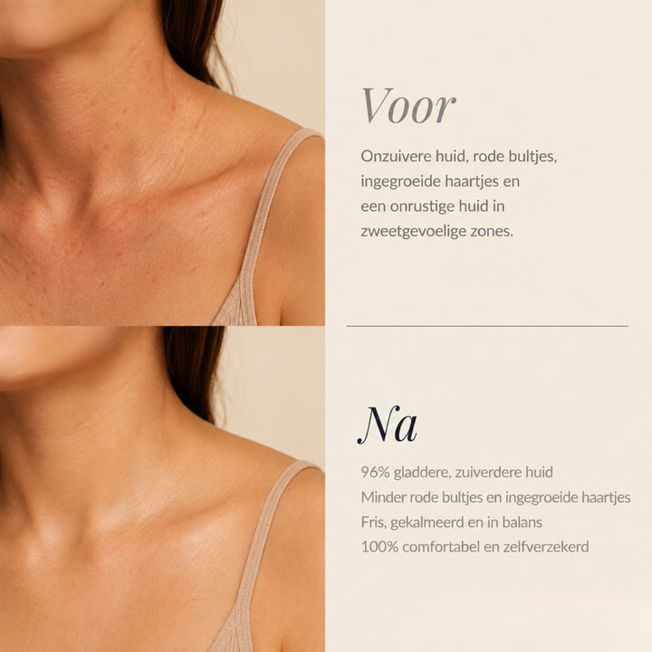 TeaFresh Body Bar | FRIS WAAR JE HET MEEST ZWEET