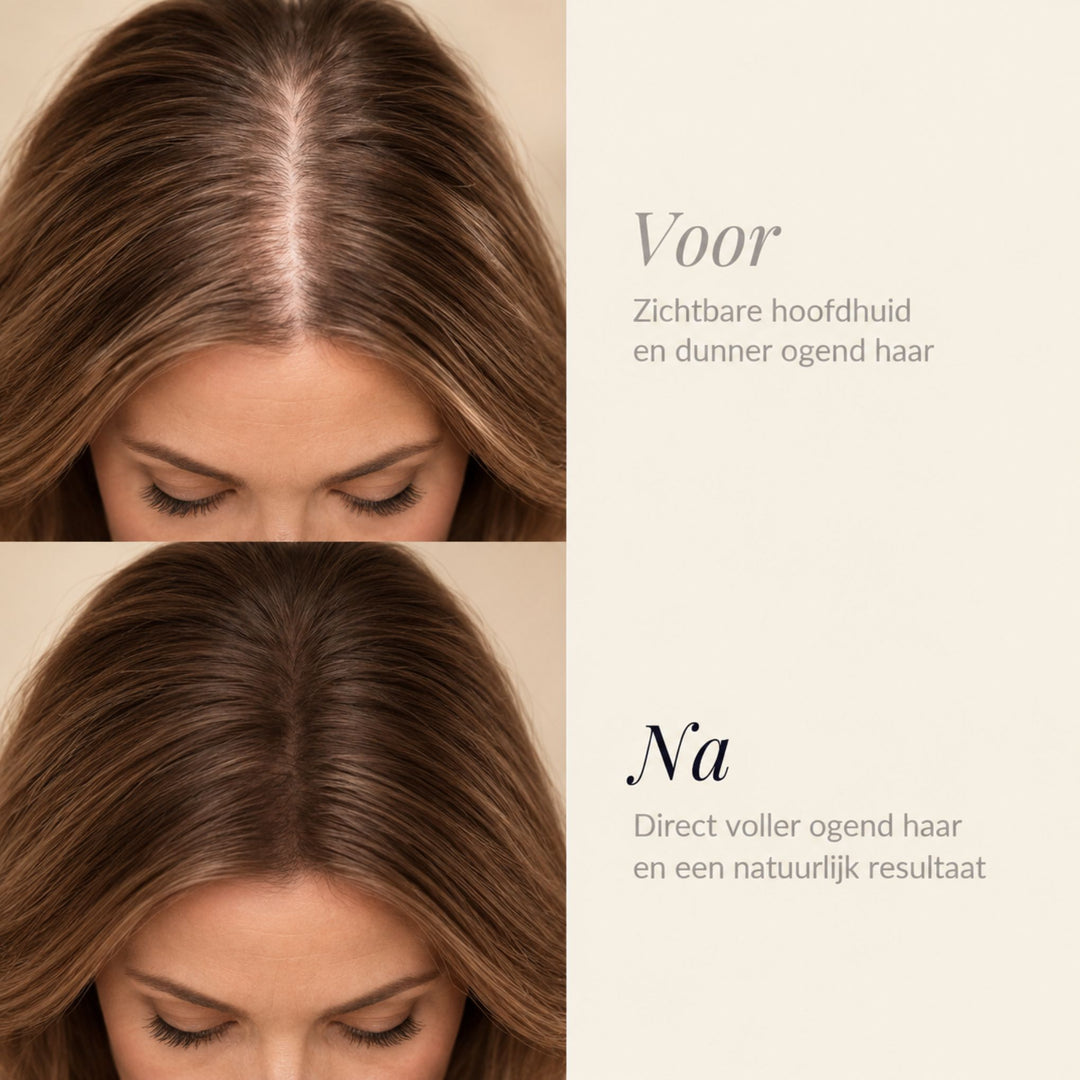 DENSEFIX HAIR CONCEALER | UITGROEISPRAY
