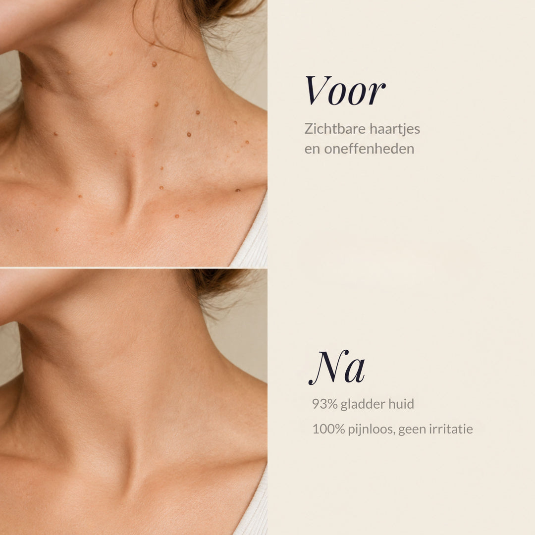 Smoothelle Skin Tag Roller | GERICHTE HUIDVERZORGING MET ROLL-ON SERUM
