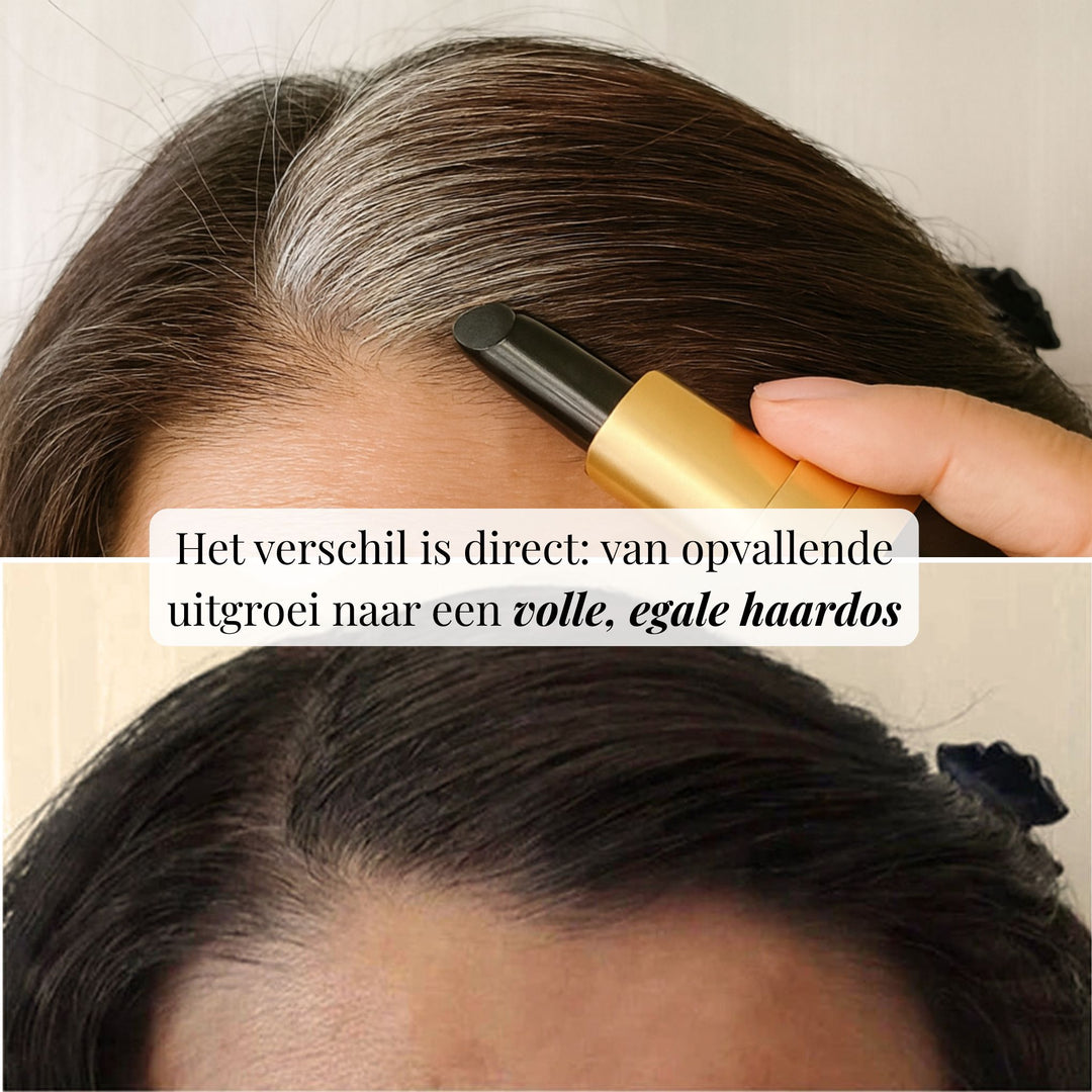 ROOTEASE ANSATZSTIFT