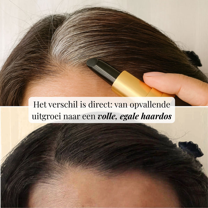 ROOTEASE ANSATZSTIFT