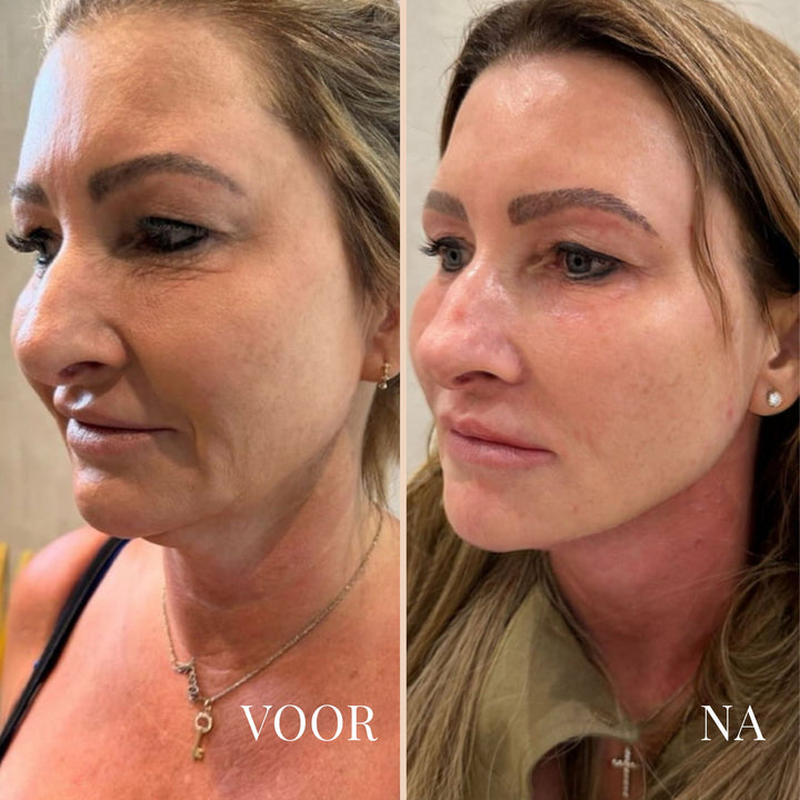 LinaLift Nekverzorgingsset