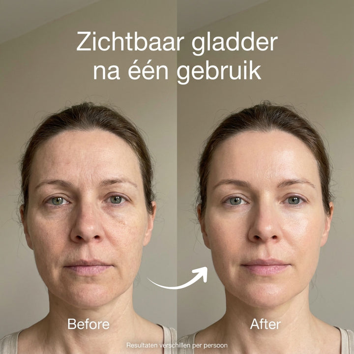 BareGlow Comfort Peeling-Gel