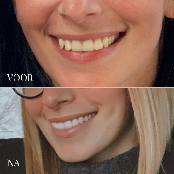 SMILESCULPT ULTRASCHALL-ZAHNBÜRSTE