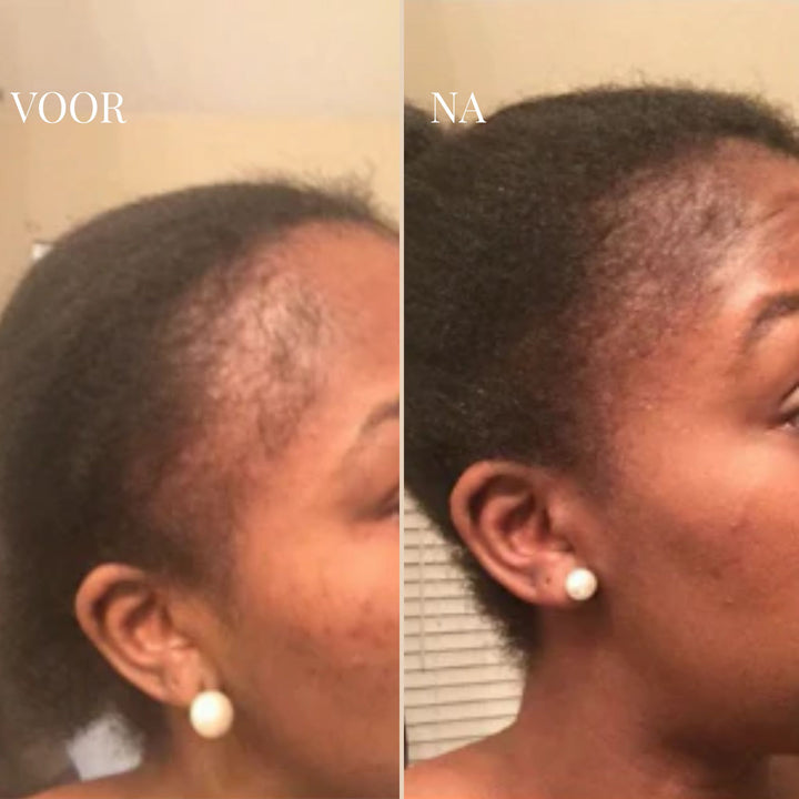 CURLVIBE | LASSEN SIE IHR HAAR WIEDER JUGENDLICH WIRKEN