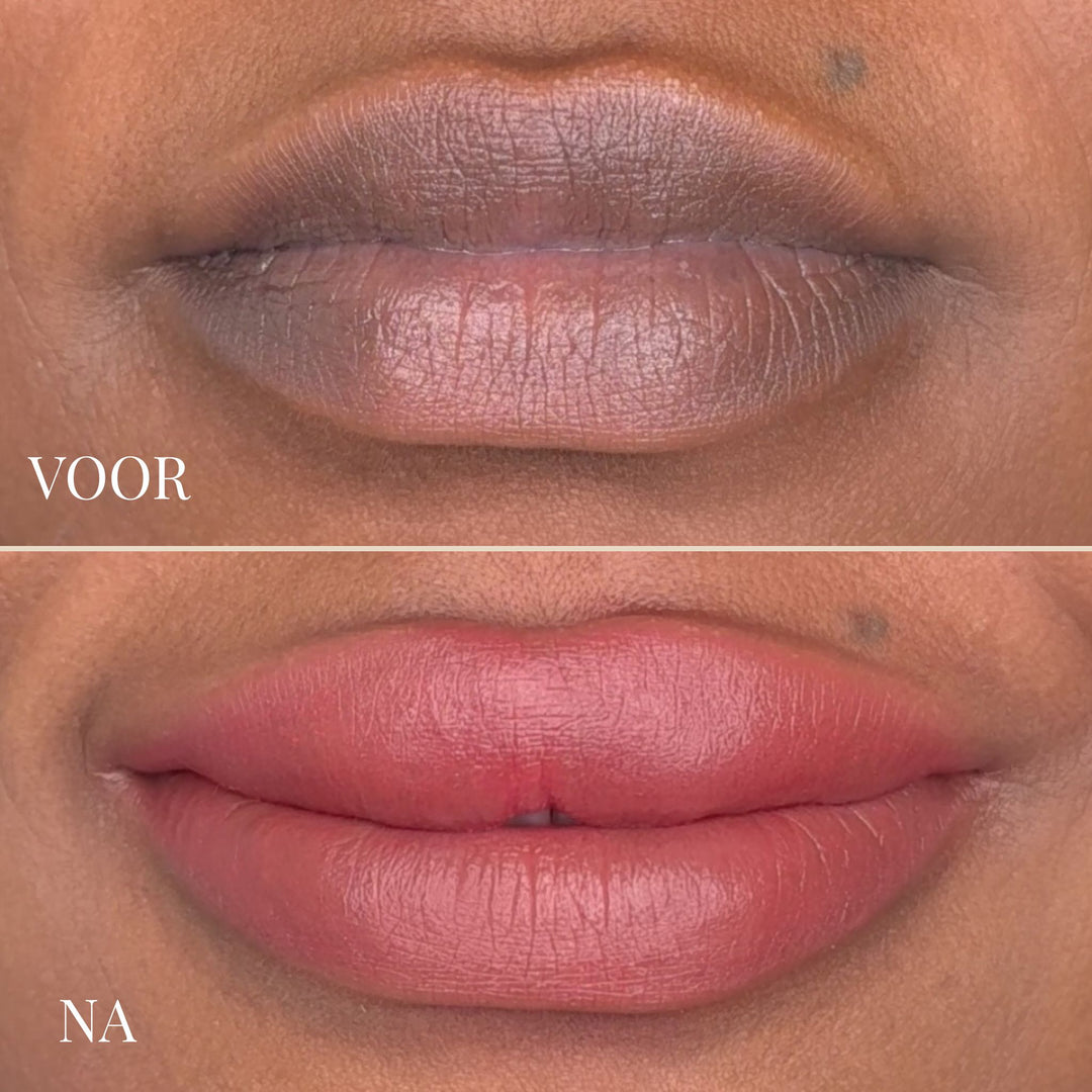 LIPBRIGHT DARK LIPS CREAM | ZICHTBAAR ROZE LIPPEN IN 1-2 WEKEN