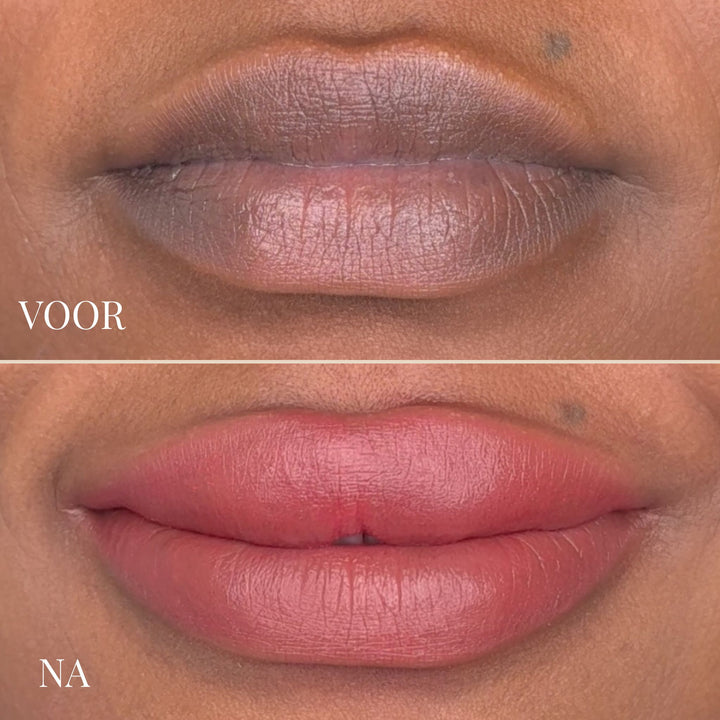 LIPBRIGHT DARK LIPS CREAM | ZICHTBAAR ROZE LIPPEN IN 1-2 WEKEN