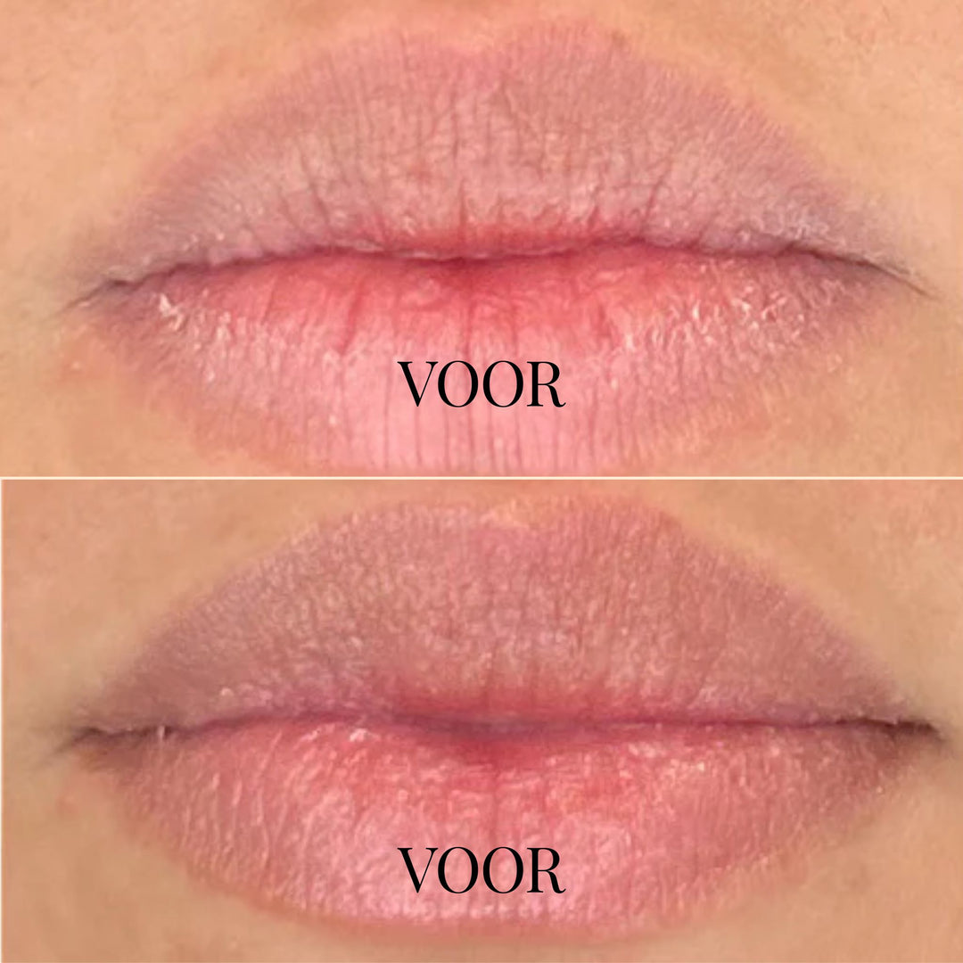 DewKiss Lipbalsem