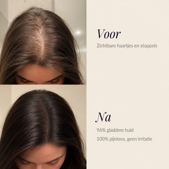 Polar Hair Rich Kleurshampoo | DEKT GRIJS IN 10 MINUTEN