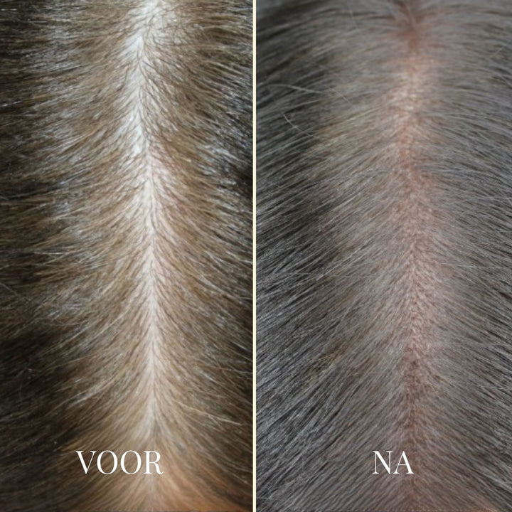 ROOTEASE ANSATZSTIFT