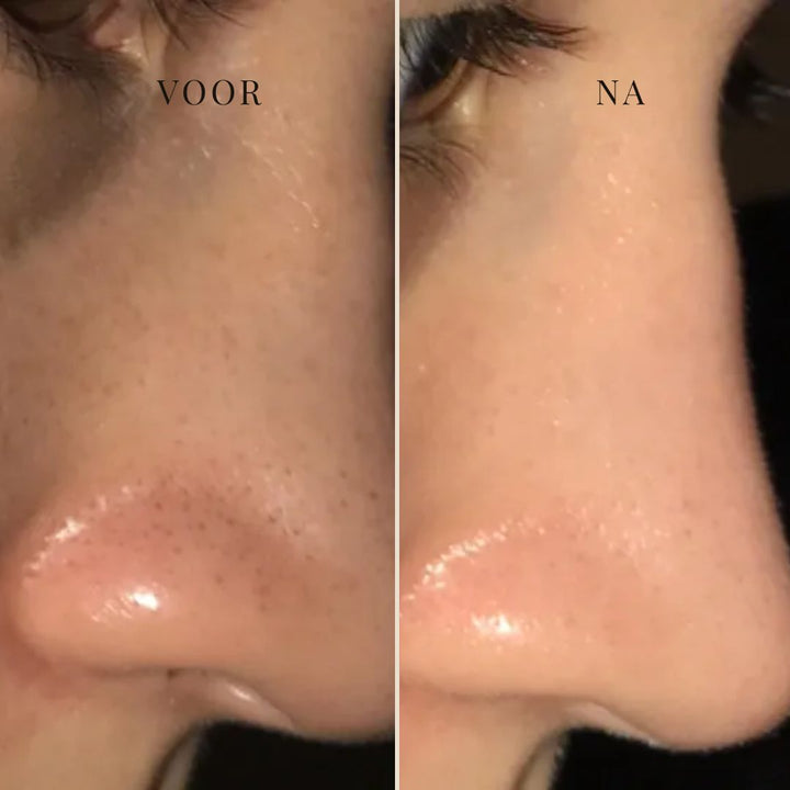 CLEARSILK | NASENMASKE GEGEN TALG