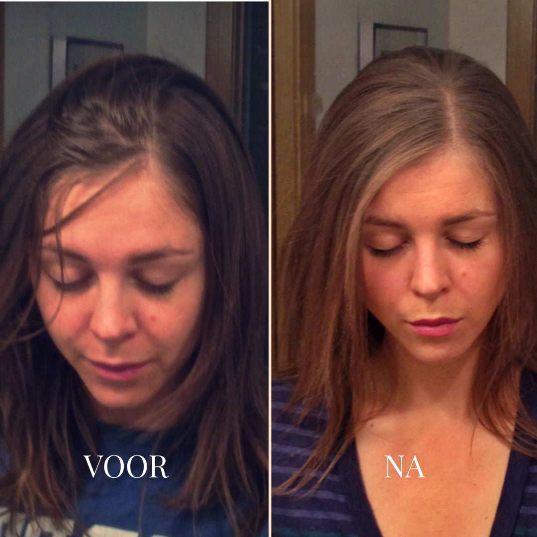 FrizzHalo Elektrische Haarborstel
