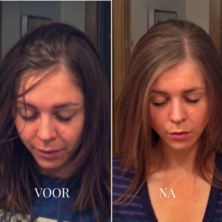 FrizzHalo Elektrische Haarborstel