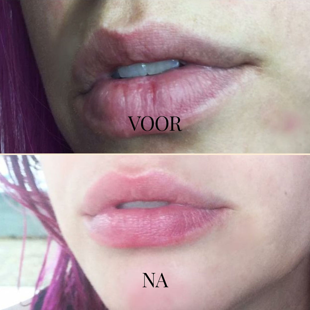 DewKiss Lipbalsem