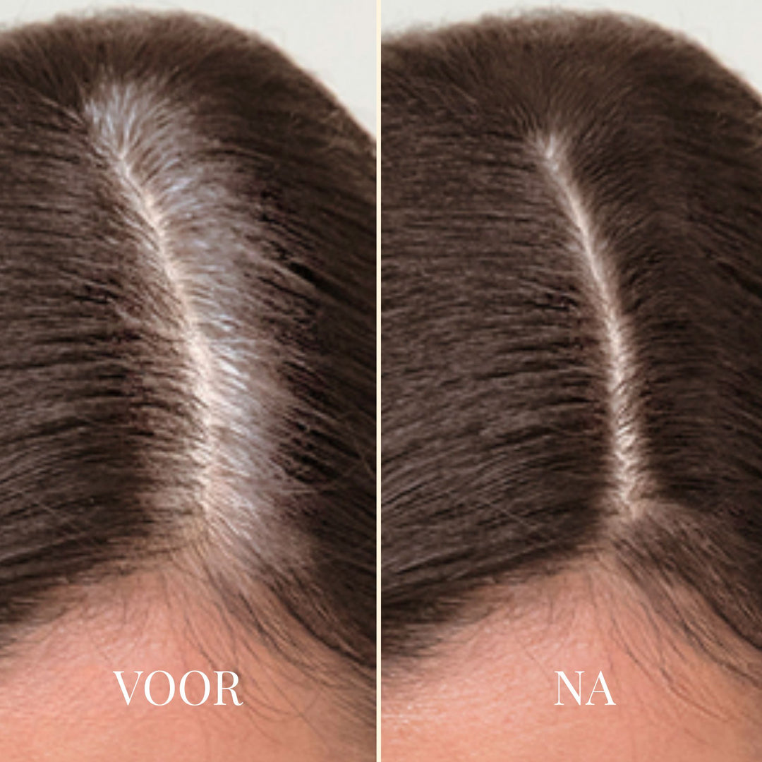 ROOTEASE ANSATZSTIFT