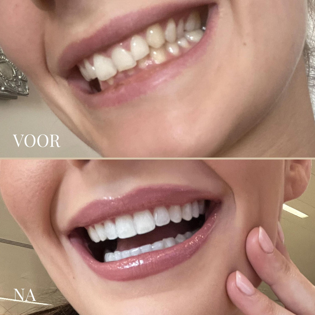 SMILESCULPT ULTRASCHALL-ZAHNBÜRSTE