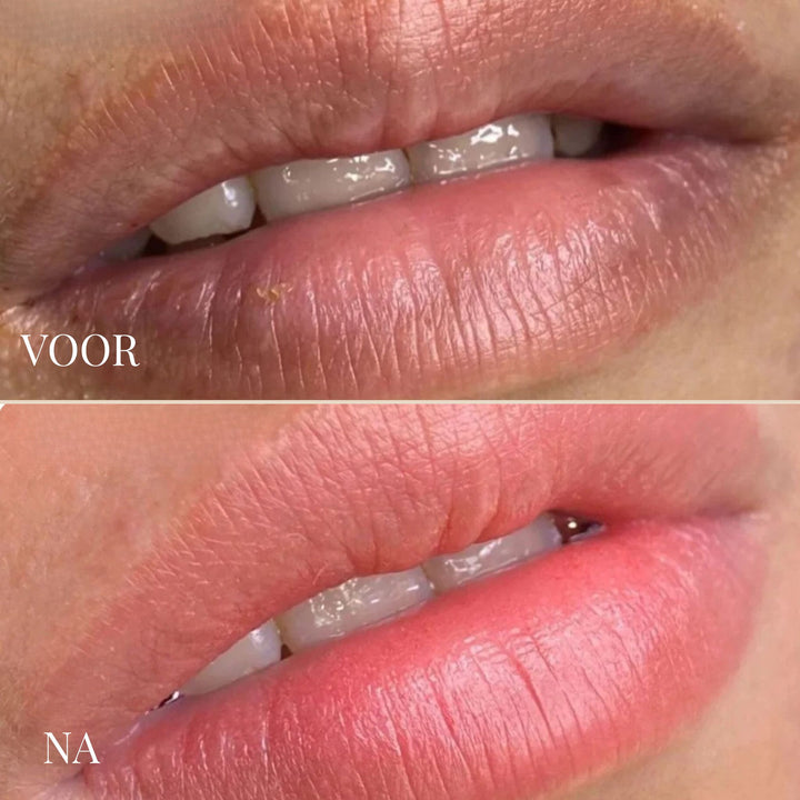 LIPBRIGHT DARK LIPS CREAM | ZICHTBAAR ROZE LIPPEN IN 1-2 WEKEN