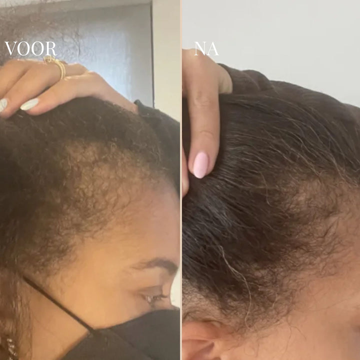 CURLVIBE | LASSEN SIE IHR HAAR WIEDER JUGENDLICH WIRKEN