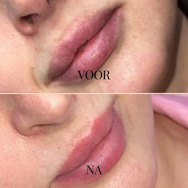 DewKiss Lipbalsem